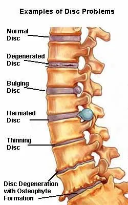 lumbar.JPG