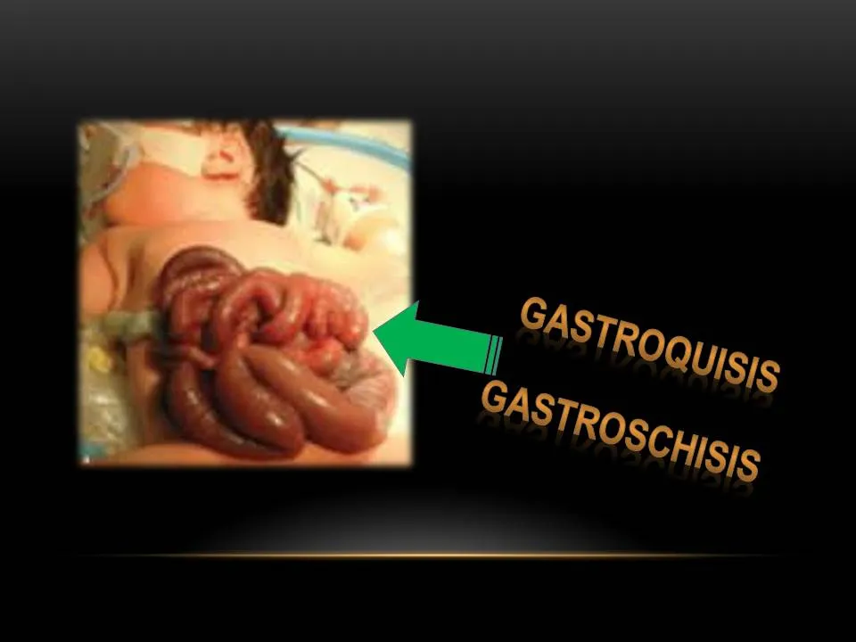 gastro.jpg