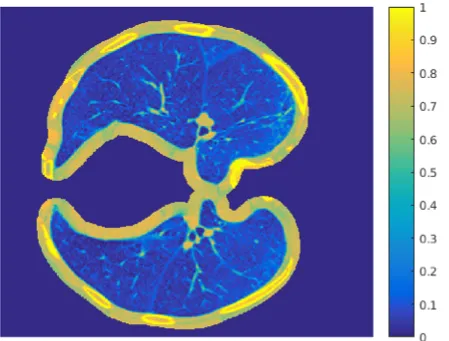 lung_area2.png