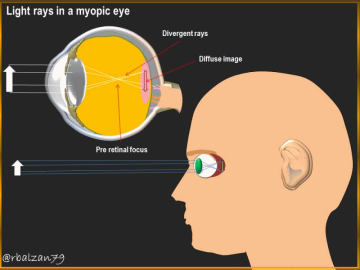 Gif_Refractive power.gif